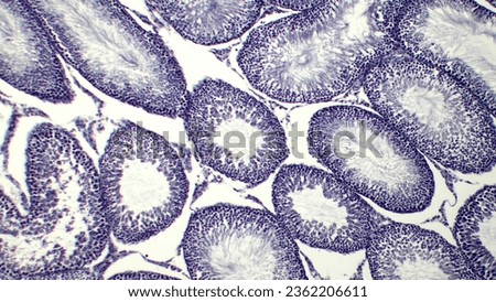 Histological Slice of Seminiferous Tubules Royalty-Free Stock Photo #2362206611