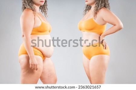 Tummy tuck, woman's fat body before and after weight loss and liposuction on gray studio background, plastic surgery concept