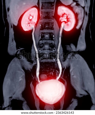 Magnetic resonance urography (MR urography) is a MRI study that predominantly used to image congenital abnormalities of the urinary system.  Royalty-Free Stock Photo #2363426143