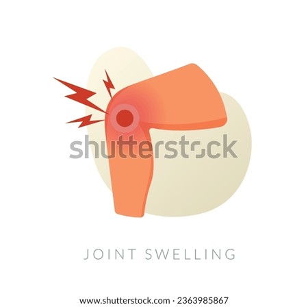 Calf Muscle Pain - Joint Swelling - Stock Illustration as EPS 10 File Royalty-Free Stock Photo #2363985867