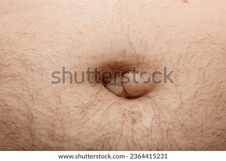 Lump in Belly Button - hernia, an inflammatory condition - possible cancer Royalty-Free Stock Photo #2364415231