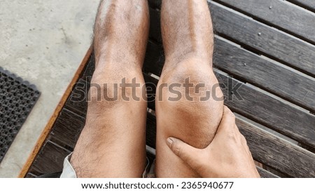 ligament sprain, dislocation of the kneecap, patella knee cap injury due to direct impact from a hard object during the sepak takraw sport, which causes pain, bruising and swelling of muscle tissue,  Royalty-Free Stock Photo #2365940677