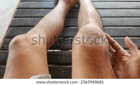 ligament sprain, dislocation of the kneecap, patella knee cap injury due to direct impact from a hard object during the sepak takraw sport, which causes pain, bruising and swelling of muscle tissue, I Royalty-Free Stock Photo #2365940681