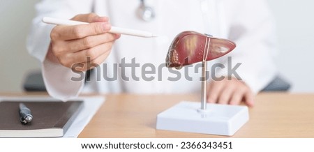 Doctor with human Liver anatomy model. Liver cancer and Tumor, Jaundice, Viral Hepatitis A, B, C, D, E, Cirrhosis, Failure, Enlarged, Hepatic Encephalopathy, Ascites Fluid in Belly and health concept Royalty-Free Stock Photo #2366343451