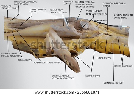 this picture is showing back of the lower thigh, popliteal fossa and back of the leg region. it contains related muscles, nerves, artery, tendons and subcutaneous bones