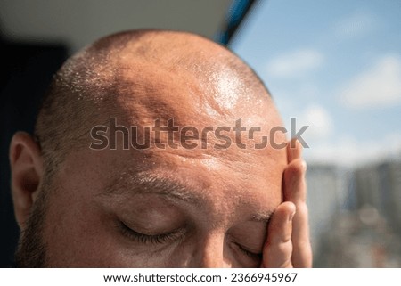 Man forehead, sunstroke, sweat on face, bald head. Close up. Guy suffers from heat, high temperature and humidity, pressure, being in hot scorching summer sun at balcony, overheating superheating Royalty-Free Stock Photo #2366945967