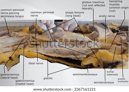 the anatomy of lower gluteal region, back of the thigh and back of the leg with popliteal fossa. picture contains related muscles, nerves, bony prominence and fossa. Royalty-Free Stock Photo #2367161221