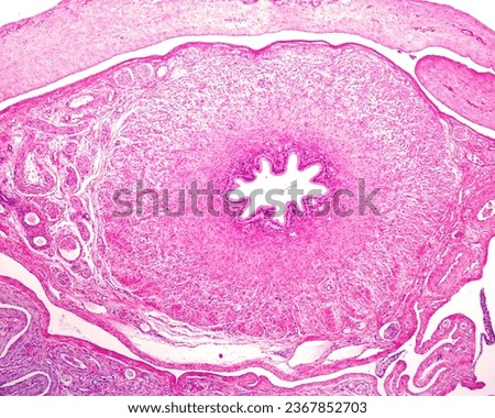 Spermatic cord showing a cross-sectioned vas deferens (ductus deferens) with a thick muscular layer surrounding the internal mucosal layer. It connects epididymis with ejaculatory duct in  the urethra Royalty-Free Stock Photo #2367852703