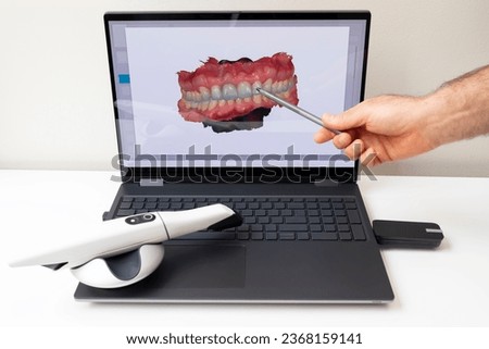 Dentist Shows 3D Scanned Picture of Scanned Teeth on Monitor of Computer, White 3d Intraoral Dental Tooth Scanner Lying on Table. Dental Equipment, Device For Scanning Teeth. Dentistry. Horizontal