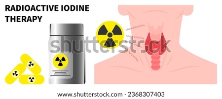 Nuclear medicine for Neck swelling with Radioactive iodine to treat Graves' and Hashimoto's disease Royalty-Free Stock Photo #2368307403