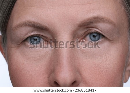Senior woman with aging skin on white background, closeup. Rejuvenation treatment