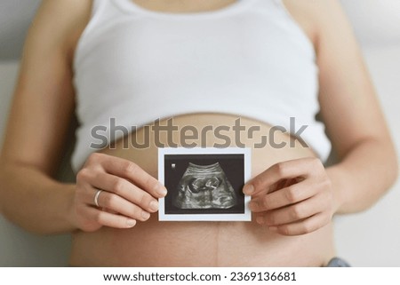 Close up Pregnant woman holding ultrasound scan photo on her belly. Concept of pregnancy, Maternity prenatal care