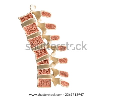 Model of the human spine isolated on a white background showing various defects in the bones and vertebrae. From bottom to top: normal vertebral bone, compression fracture, wedge fracture, osteoporose Royalty-Free Stock Photo #2369713947