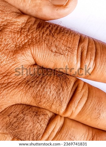 Brown hairy dry skin of human hand. Brown hand fingers with hairy skin.