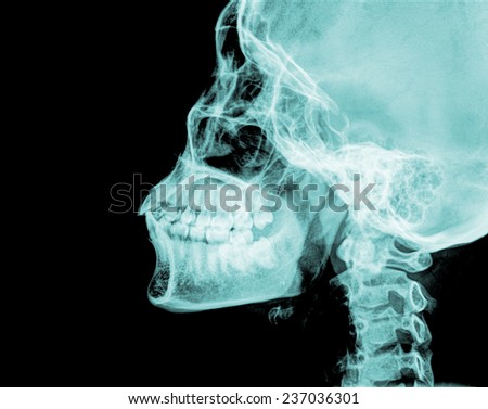 Detail of neck and head x-ray image.