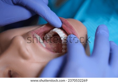 Doctor dentist examining patient oral cavity with veneers closeup. Installation of composite and zirconium veneers concept Royalty-Free Stock Photo #2370532269