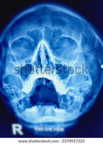  X-ray picture of the human's skull.