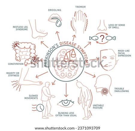 Parkinson's disease symptoms. Mental deficiency, unstable posture, rigidity, drooling. Medical infographic with linear icons. Editable vector illustration in line style isolated on a white background Royalty-Free Stock Photo #2371093709