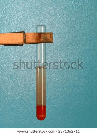 The presence of reducing sugars is indicated by the appearance of reddish-brown precipitate in test tubes. Royalty-Free Stock Photo #2371362711