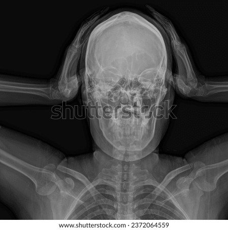 This is a picture of X-ray holding his own head.