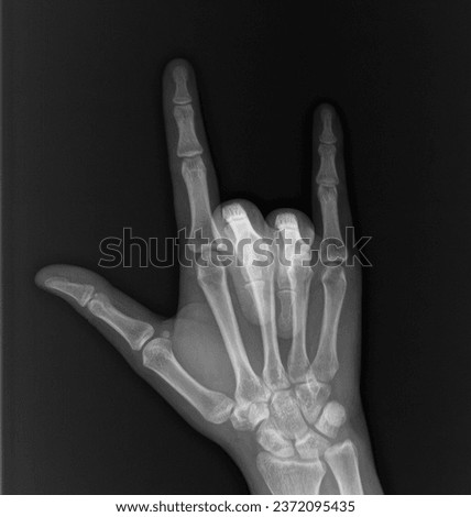 This is an x-ray image of my hand in the I love you pose.