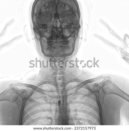 This is a picture of a person holding up two fingers to take a photo. But it's an X-ray image.