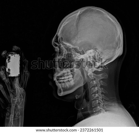 X-ray image, people taking pictures