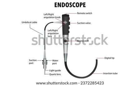 Diagram of the endoscope, parts of the endoscope