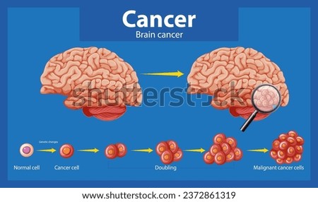 Illustrated guide to brain cancer and abnormal cell development