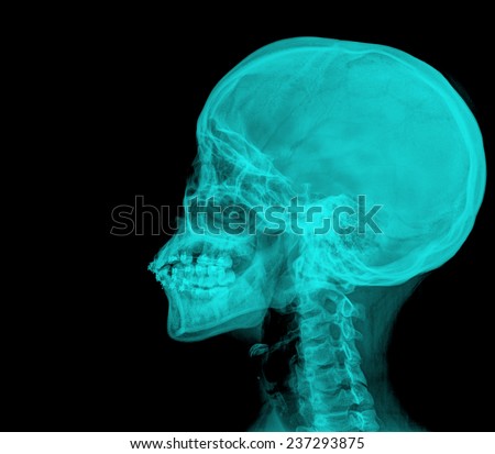 photo of side x-ray picture of human skull in natural colors