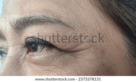 Facial skin problems of crow feet, freckles, dark spots and wrinkles on the faces of Asain women stressed expression, frowning, Dry and rough skin, Isolated on white background and concept of healthy Royalty-Free Stock Photo #2373378131