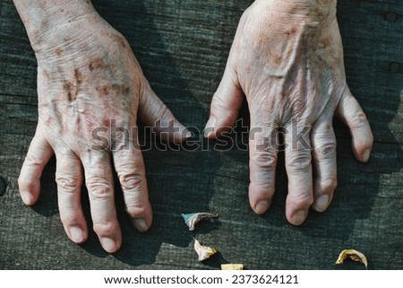 Elderly hands, showcasing a life's journey through their blemishes and creases, rest in a calming forest environment, contrasting with the surroundings Royalty-Free Stock Photo #2373624121