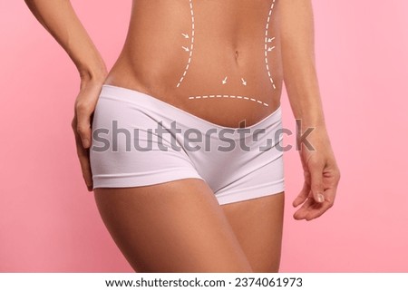 Woman with markings for cosmetic surgery on her abdomen against pink background, closeup Royalty-Free Stock Photo #2374061973