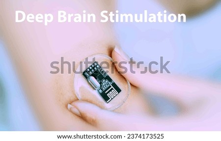 Deep brain stimulation: Involves implanting electrodes in the brain to alleviate symptoms of Parkinson's disease and other neurological disorders. Royalty-Free Stock Photo #2374173525