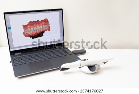 3D Scanned Picture of Scanned Teeth on Monitor of Computer, Notebook. White 3d Intraoral Dental Tooth Scanner Lying on Table. Copy Space. Dental Equipment, Device For Scanning Teeth. Horizontal Plane