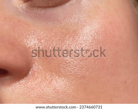 Macro photo of big pore on oily facial skin type. Skin with enlarged pores. Care for problem skin. Sun, natural light Royalty-Free Stock Photo #2374660731