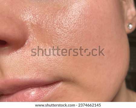 Macro photo of big pore on oily facial skin type. Skin with enlarged pores. Care for problem skin. Sun, natural light Royalty-Free Stock Photo #2374662145