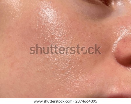 close-up girl with sweaty skin on her face and excessive oily sheen, excessive sweating, hyperhidrosis disease Royalty-Free Stock Photo #2374664395