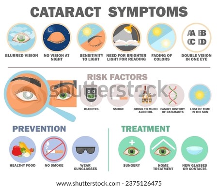 Cataract symptom, risk factor, prevention and treatment infographic vector medical poster illustration. Eye vision disease problem awareness and help Royalty-Free Stock Photo #2375126475