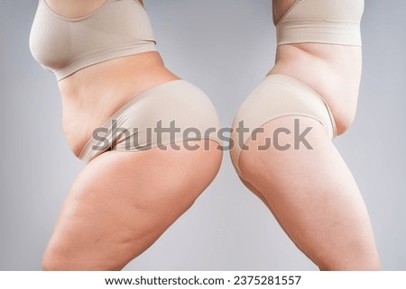 Two overweight women with fat flabby bellies, legs, hips and buttocks on gray studio background, plastic surgery and body positive concept