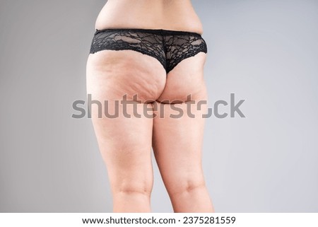Overweight woman with fat legs, hips and buttocks, obesity female body with cellulite and varicose veins on gray studio background