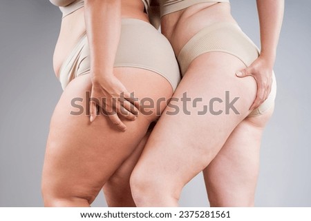 Two overweight women with fat flabby bellies, legs, hands, hips and buttocks on gray studio background, plastic surgery and body positive concept