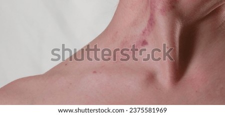 Traces of Violence on a Woman Neck. Dramatic photo. The concept of protecting women's rights. Abuser behavior Royalty-Free Stock Photo #2375581969