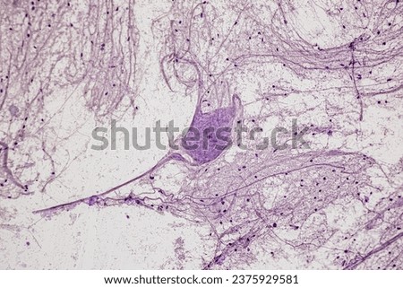 Motor Neuron, Spinal cord, Nerve fibres and nerve cells under the microscope in Lab. Royalty-Free Stock Photo #2375929581