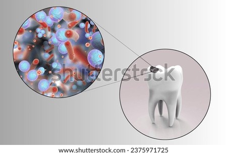 3D Cute Cartoon Tooth Character with Gum Problem Vector Illustration. Swolen Gum Concept. Illustrstion of Gum Disease. Periodontal Disease. Periodontitis Disease