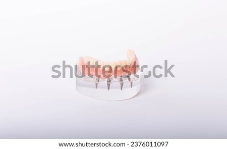 render of mandibular prosthesis all on 4 system supported by implants over white background Royalty-Free Stock Photo #2376011097