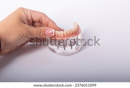 render of mandibular prosthesis all on 4 system supported by implants over white background Royalty-Free Stock Photo #2376011099