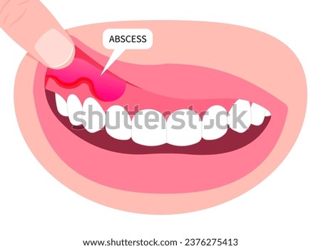 Gum swollen and bad breath with teeth cavities broken wisdom cracked pain oral hygiene health