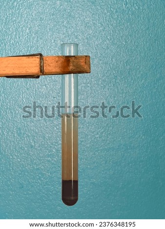 The presence of reducing sugars is indicated by the appearance of reddish-brown precipitate in test tubes. Royalty-Free Stock Photo #2376348195