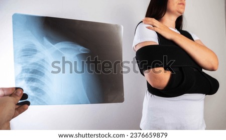 The doctor holds in his hand a medical x-ray of a dislocated humerus and a fractured collarbone against the background of a girl patient whose shoulder hurts. Fixing bandage for the shoulder joint.  Royalty-Free Stock Photo #2376659879